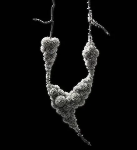 Pearls25